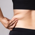 Enhance Your Weight Loss Journey With Laser Liposuction Treatments In Frankfort