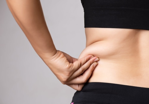 Enhance Your Weight Loss Journey With Laser Liposuction Treatments In Frankfort